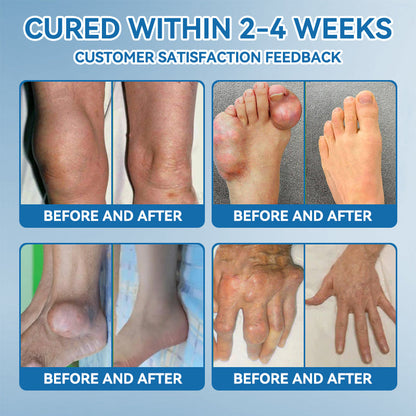 𝖯𝗂𝖼𝗱𝗼® 💪 BPC-157 Joint Healing Cream👨‍🔬Treats Arthritis, Neuropathy, Rheumatism, Sports Injuries & More