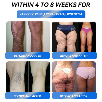 𝑂𝑓𝑓𝑖𝑐𝑖𝑎𝑙 𝑆𝑡𝑜𝑟𝑒🇦🇺IFMAGIC® GLP-1 Pro Weight Loss Oral Solution 💊7 days visible effect, no side effects, suitable for all age groups👨‍🔬