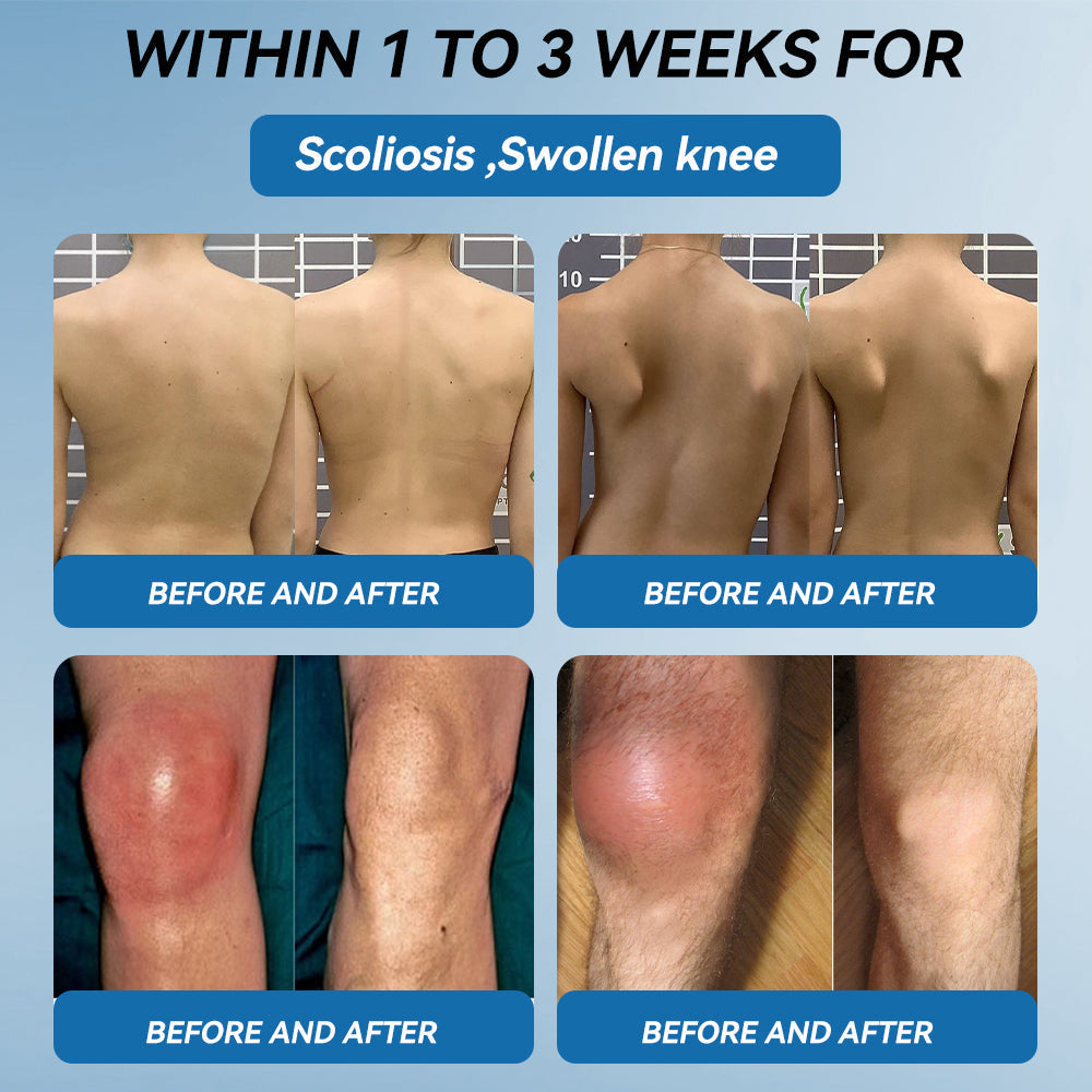 𝖯𝗂𝖼𝗱𝗼® 💪 BPC-157 Joint Healing Cream👨‍🔬Treats Arthritis, Neuropathy, Rheumatism, Sports Injuries & More