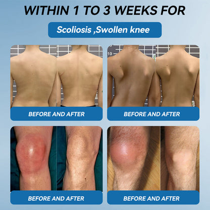 𝖯𝗂𝖼𝗱𝗼® 💪 BPC-157 Joint Healing Cream👨‍🔬Treats Arthritis, Neuropathy, Rheumatism, Sports Injuries & More