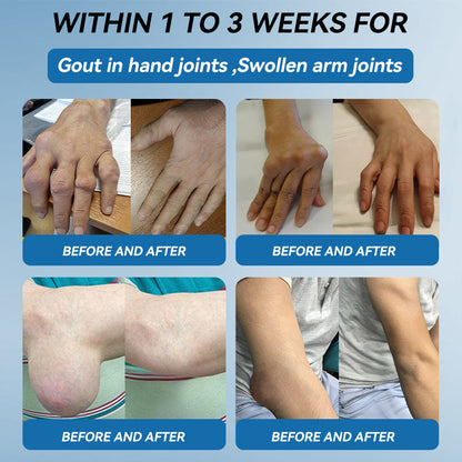 𝖯𝗂𝖼𝗱𝗼® 💪 BPC-157 Joint Healing Cream👨‍🔬Treats Arthritis, Neuropathy, Rheumatism, Sports Injuries & More
