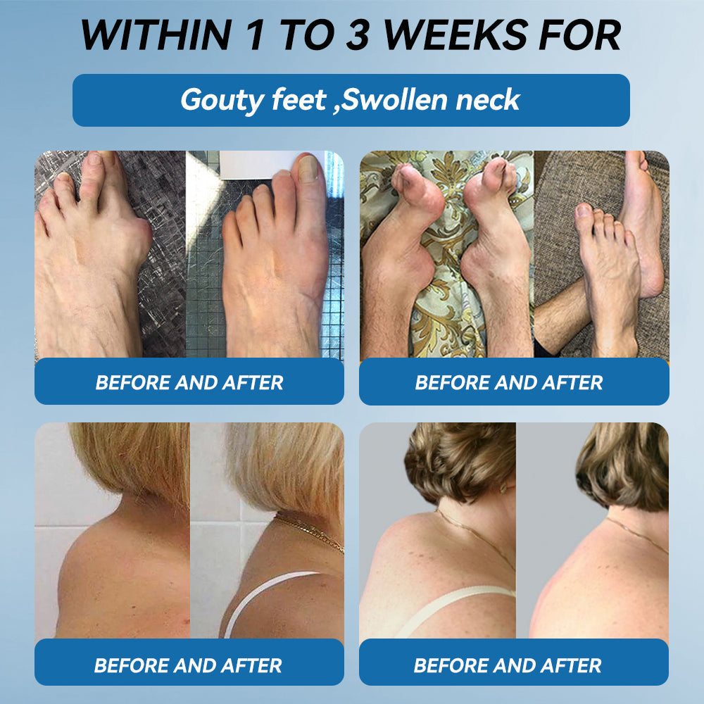 𝖯𝗂𝖼𝗱𝗼® 💪 BPC-157 Joint Healing Cream👨‍🔬Treats Arthritis, Neuropathy, Rheumatism, Sports Injuries & More